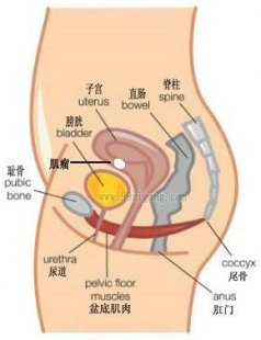 豆花子：豆花子宫肌瘤可以吃吗